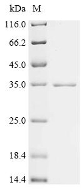 Recombinant Mouse Hemoglobin subunit alpha (Hba) (CSB-EP010147MOa2) Recombinant Mouse Hemoglobin subunit alpha (Hba) (CSB-EP010147MOa2)