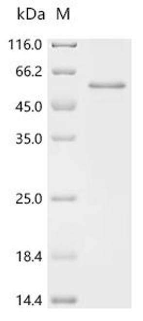 Recombinant Rat Latent transforming growth factor beta binding protein 4 (Ltbp4), partial (CSB-EP6158RA) Recombinant Rat Latent transforming growth factor beta binding protein 4 (Ltbp4), partial (CSB-EP6158RA)