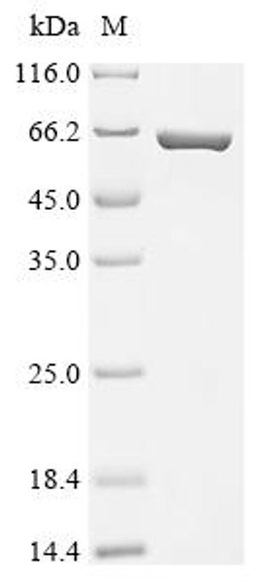 Recombinant Escherichia coli Periplasmic trehalase (treA) (CSB-EP319553ENV) Recombinant Escherichia coli Periplasmic trehalase (treA) (CSB-EP319553ENV)