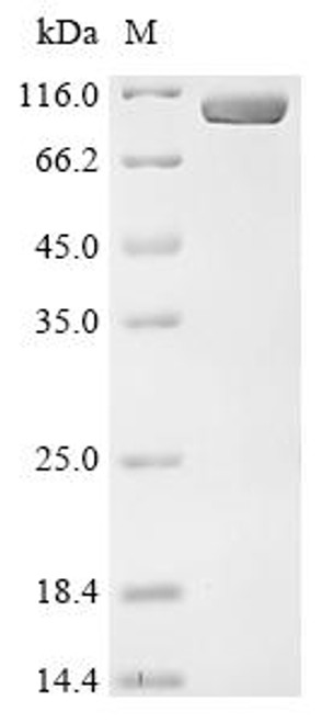 Recombinant Escherichia coli Aconitate hydratase (CSB-EP6086ENR(A4)) Recombinant Escherichia coli Aconitate hydratase (CSB-EP6086ENR(A4))