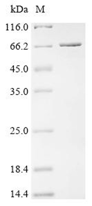 Recombinant Escherichia coli Alpha,alpha-phosphotrehalase (CSB-EP6100ENR) Recombinant Escherichia coli Alpha,alpha-phosphotrehalase (CSB-EP6100ENR)