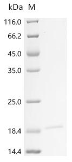 Recombinant Human Voltage-dependent calcium channel gamma-1 subunit (CACNG1), partial (CSB-EP004415HU1) Recombinant Human Voltage-dependent calcium channel gamma-1 subunit (CACNG1), partial (CSB-EP004415HU1)