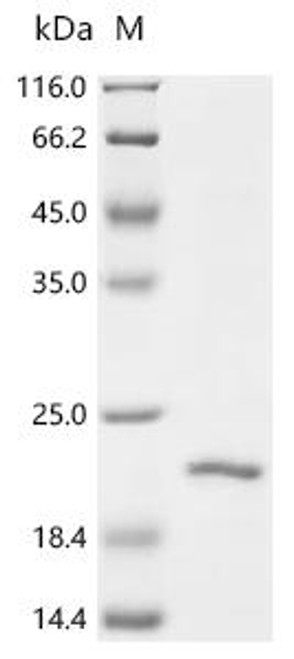 Recombinant Cat Beta-2-microglobulin (B2M) (CSB-EP002486CA) Recombinant Cat Beta-2-microglobulin (B2M) (CSB-EP002486CA)