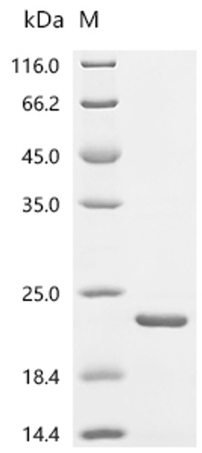 Recombinant Human Bromodomain-containing protein 2 (BRD2), partial (CSB-EP002800HU1)