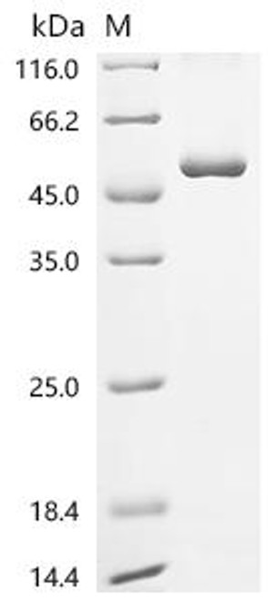 Recombinant Human Uncharacterized protein C8orf76 (C8orf76) (CSB-EP856963HU)