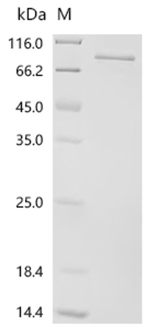 Recombinant Human Polyunsaturated fatty acid 5-lipoxygenase (ALOX5) (CSB-EP001624HU)