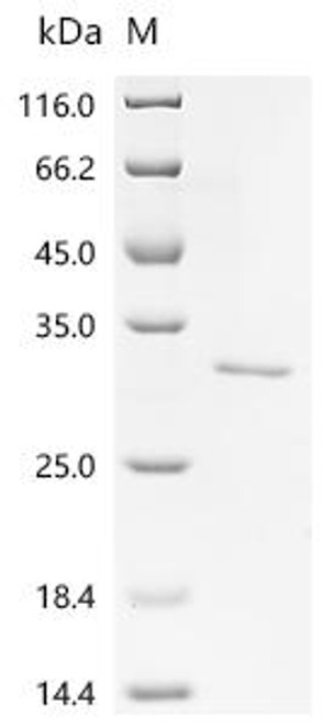 Recombinant Escherichia coli Transposon Tn3 resolvase (tnpR) (CSB-EP364980ENL)