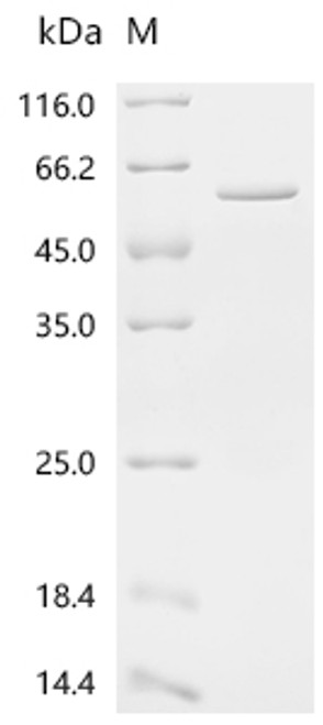 Recombinant Mouse Neurogenic differentiation factor 1 (Neurod1)(H241A) (CSB-EP720182MO(M3))