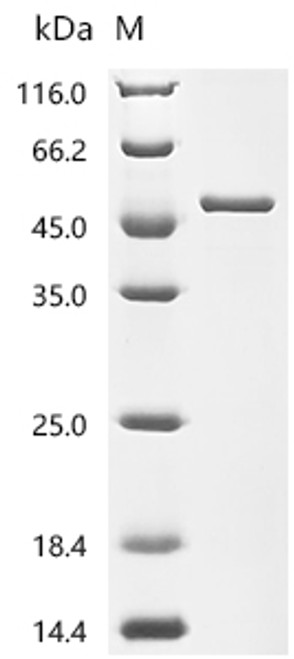 Recombinant Mouse Adenosine deaminase (Ada) (CSB-EP001268MO)