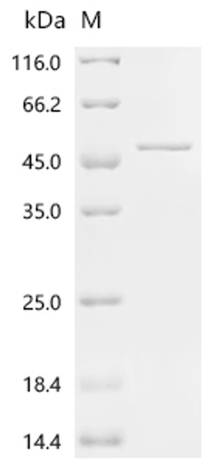 Recombinant Spinacia oleracea Phosphoribulokinase, chloroplastic (CSB-EP362728FKI)