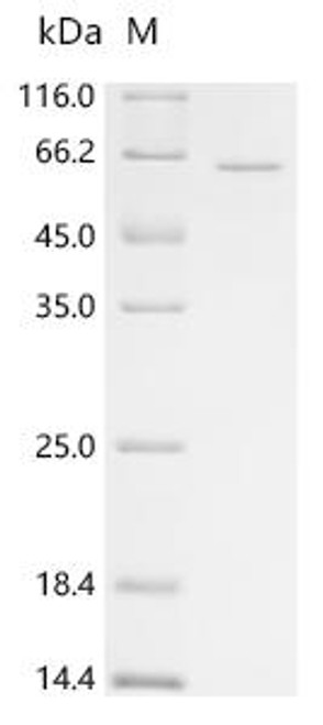 Recombinant Human L-amino-acid oxidase (IL4I1), partial (CSB-EP850426HU1)