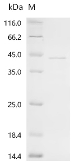 Recombinant Vespula vulgaris Phospholipase A1 (CSB-EP343003VETc7)