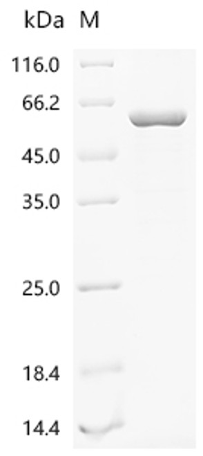 Recombinant Mouse Histone deacetylase 2 (Hdac2) (CSB-EP010238MO)
