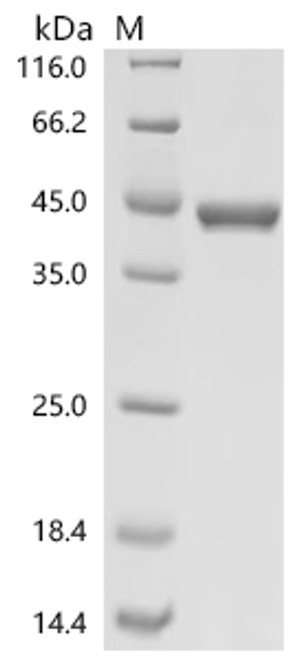 Recombinant Mouse Aldo-keto reductase family 1 member A1 (Akr1a1) (CSB-EP878064MO)