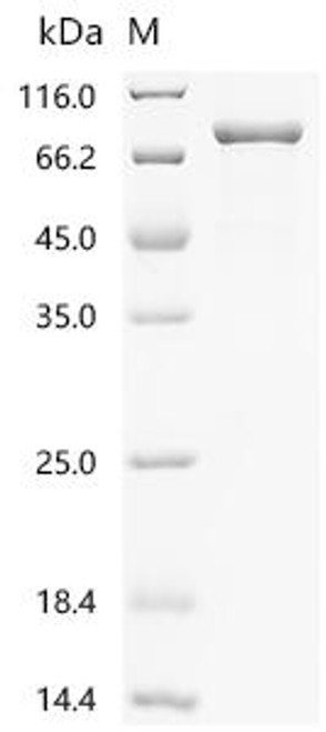 Recombinant Human Multiple inositol polyphosphate phosphatase 1 (MINPP1) (CSB-EP891977HUf0)