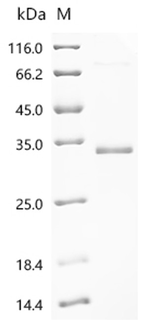 Recombinant Macaca fascicularis Lymphotoxin beta receptor (LTBR), partial (CSB-EP6176MOV)