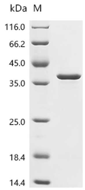 Recombinant Escherichia coli O6:H1 DNA-binding dual transcriptional regulator OmpR (ompR) (CSB-EP359384FQR)