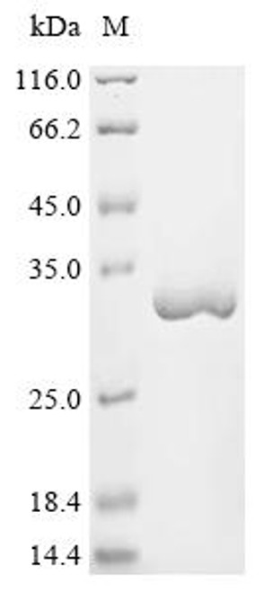 Recombinant Saponaria officinalis Ribosome-inactivating protein saporin-9 (SAP9) (CSB-YP748739SCG)