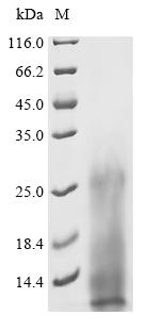 Recombinant Mycobacterium bovis ESAT-6-like protein esxB (esxB) (CSB-YP358628MVH)