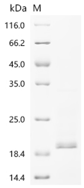 Recombinant Human Cytochrome c oxidase subunit 1 (MT-CO1), partial (CSB-YP015072HU)