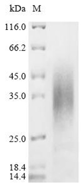 Recombinant Streptococcus agalactiae serotype III Single-stranded DNA-binding protein 1 (ssb1) (CSB-YP354227SMH)