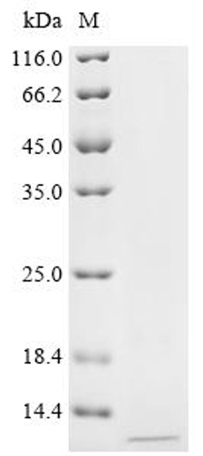 Recombinant Rabbit B (0,+)-type amino acid transporter 1 (SLC7A9), partial (CSB-YP889020RB)