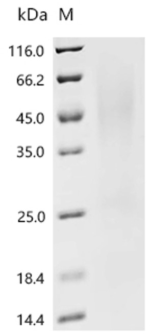 Recombinant Klebsiella pneumoniae Fimbrial subunit type 3 (mrkA) (CSB-YP318939KBGc7)