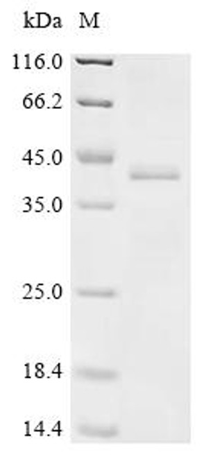 Recombinant Klebsiella pneumoniae Fimbrial subunit type 3 (mrkA) (CSB-YP318939KBG)