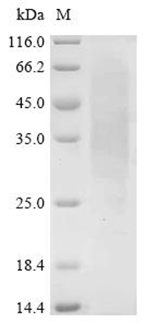 Recombinant Phleum pratense Pollen allergen Phl p 1 (PHLPI) (CSB-YP331772EUQ)