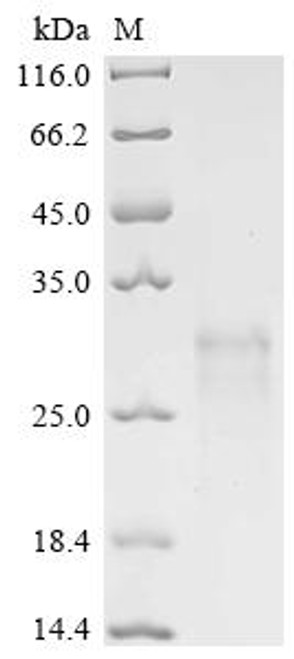 Recombinant Human Eukaryotic translation initiation factor 4E (EIF4E) (CSB-YP007556HU)