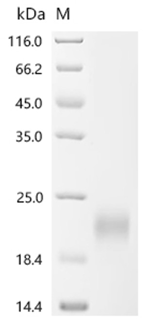 Recombinant Mouse Leukemia inhibitory factor (Lif) (CSB-YP012928MO)