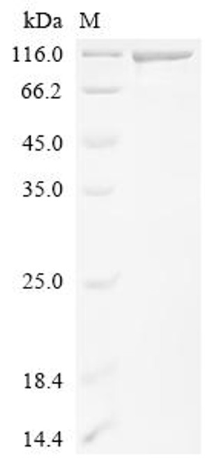 Recombinant Human E3 ubiquitin-protein ligase DTX3L (DTX3L) (CSB-YP855054HU)