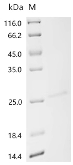 Recombinant Human Ras-related protein Rab-27A (RAB27A) (CSB-YP019177HU)