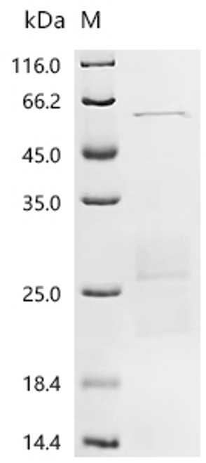 Recombinant Human Ras-related protein Rab-6B (RAB6B) (CSB-YP873642HU)