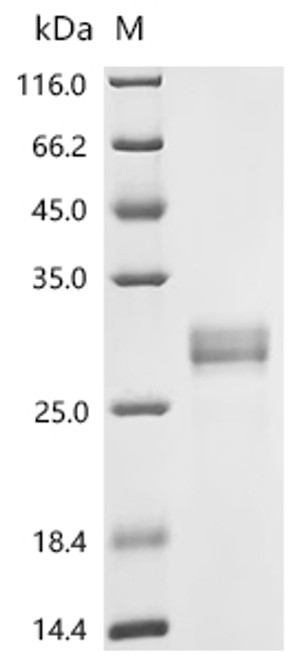Recombinant Human Ras-related protein Rab-5C (RAB5C) (CSB-YP019215HU)