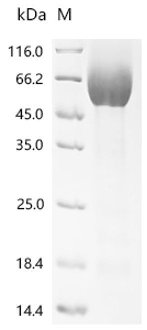 Recombinant Human Cell adhesion molecule CEACAM1 (CEACAM1), partial (Active) (CSB-YP005157HU)