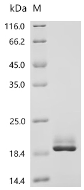 Recombinant Sheep Fibroblast growth factor 2 (FGF2) (CSB-YP008625SH)