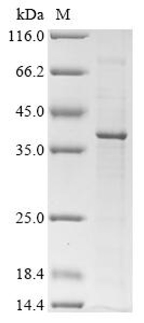 Recombinant Rat Cathepsin Z(Ctsz) (CSB-YP006206RA)