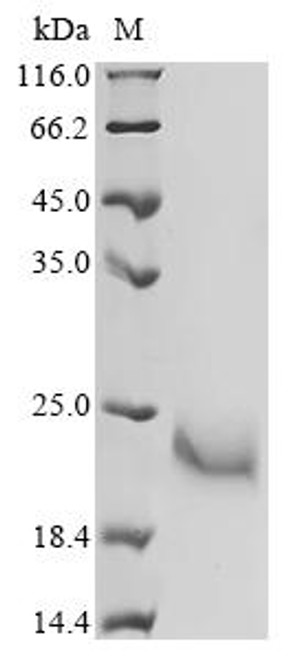 Recombinant Necator americanus Ancylostoma secreted protein 2 (ASP2) (CSB-YP3506GNW)