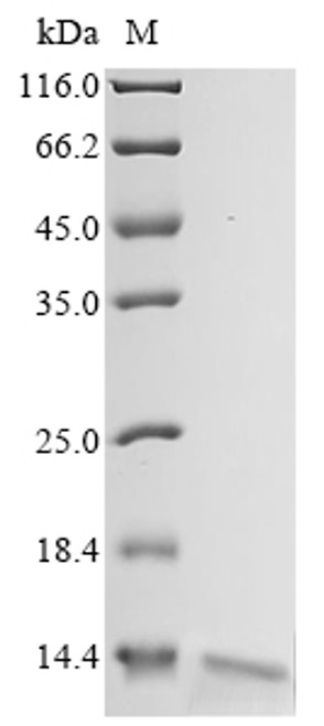 Recombinant Escherichia coli Ribonuclease E (rne), partial (CSB-YP324207ENV) Recombinant Escherichia coli Ribonuclease E (rne), partial (CSB-YP324207ENV)