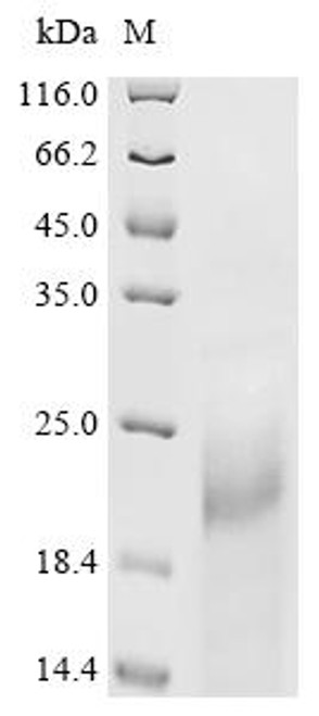 Recombinant Mouse Cyclin-dependent kinase inhibitor 1 (Cdkn1a) (CSB-YP005086MO) Recombinant Mouse Cyclin-dependent kinase inhibitor 1 (Cdkn1a) (CSB-YP005086MO)