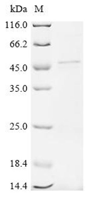 Recombinant Human Mitogen-activated protein kinase 3 (MAPK3) (CSB-YP013456HU(A5)) Recombinant Human Mitogen-activated protein kinase 3 (MAPK3) (CSB-YP013456HU(A5))