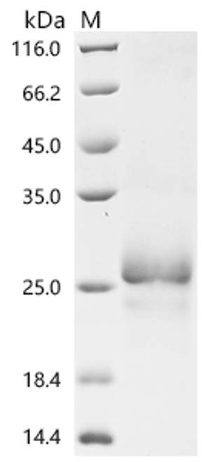 Recombinant Necator americanus Ancylostoma secreted protein 2 (ASP2) (CSB-YP3506GNWf3) Recombinant Necator americanus Ancylostoma secreted protein 2 (ASP2) (CSB-YP3506GNWf3)