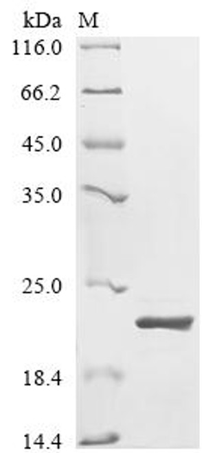 Recombinant Ganoderma lucidum Immunomodulatory protein Ling Zhi-8 (CSB-YP320455GAW) Recombinant Ganoderma lucidum Immunomodulatory protein Ling Zhi-8 (CSB-YP320455GAW)