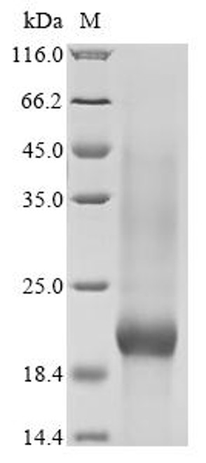 Recombinant Puccinia triticina Secreted protein (CSB-YP3751GPC) Recombinant Puccinia triticina Secreted protein (CSB-YP3751GPC)