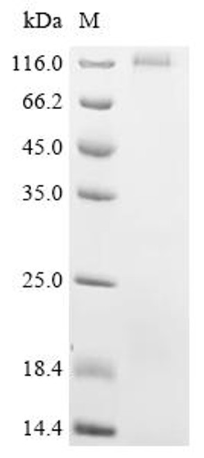 Recombinant Bovine Seizure 6-like protein 2 (SEZ6L2), partial (CSB-YP643717BO) Recombinant Bovine Seizure 6-like protein 2 (SEZ6L2), partial (CSB-YP643717BO)