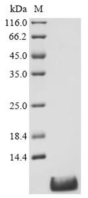 Recombinant Rat Apelin (Apln), partial (CSB-YP001909RA1) Recombinant Rat Apelin (Apln), partial (CSB-YP001909RA1)