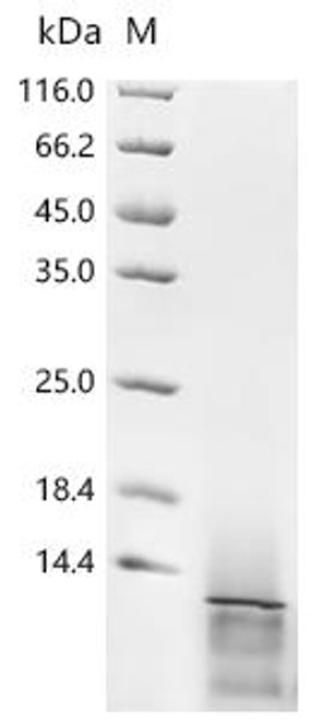 Recombinant Epstein-Barr virus Protein BMRF2 (BMRF2), partial (CSB-YP365872EFA)