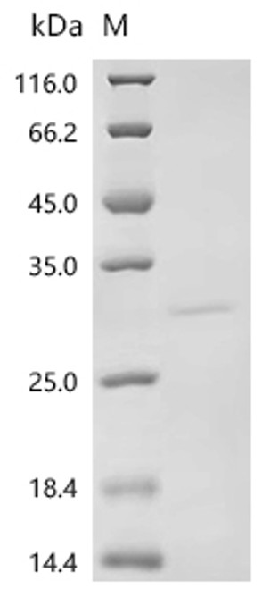 Recombinant Rotavirus A Non-structural glycoprotein 4, partial (CSB-YP465285ROJa4) Recombinant Rotavirus A Non-structural glycoprotein 4, partial (CSB-YP465285ROJa4)