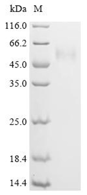 Recombinant Human Signal recognition particle subunit SRP54 (SRP54) (CSB-YP022675HU)